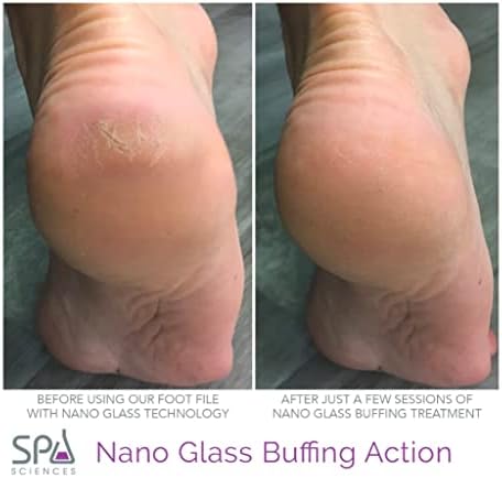 Spa Sciences Nano Glass turpija za stopala - Pedi alat za piling-cilja suhu kožu, kurje oči, žuljeve - za upotrebu na mokroj ili suvoj